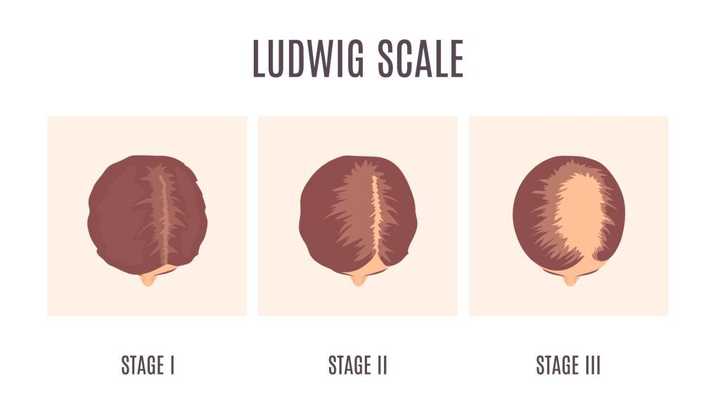 ludwing scale