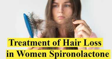 Treatment of Hair Loss in Women (Spironolactone)