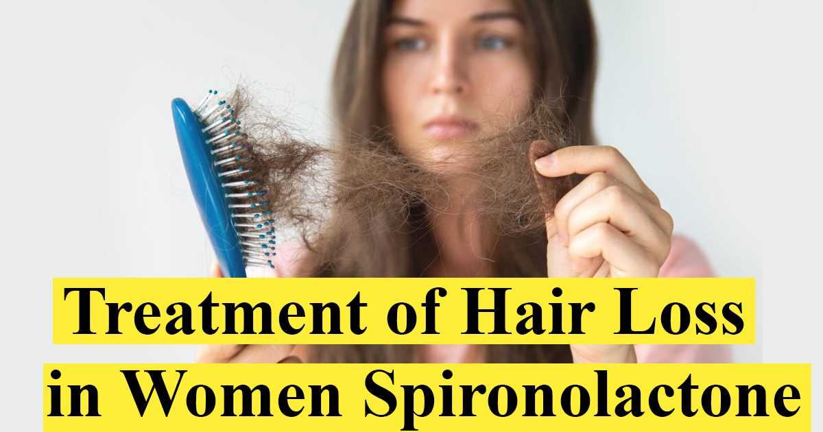Treatment of Hair Loss in Women (Spironolactone)