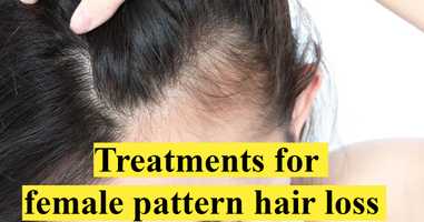 Treatments for female pattern hair loss