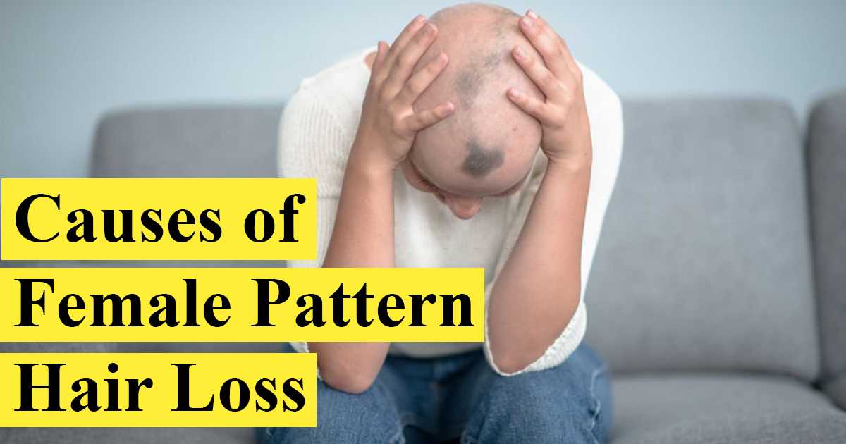 Causes of Female Pattern Hair Loss