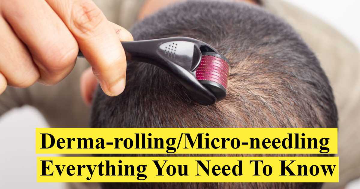 Derma-rolling/Micro-needling Everything You Need To Know
