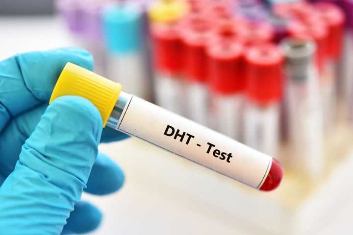 DHT hormone test 